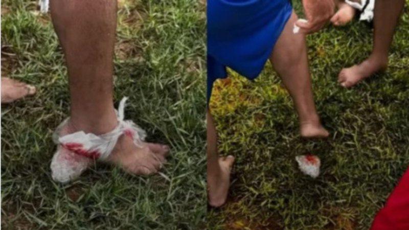 Ataque de piranhas fere 10 e interdita Rio Paraguaçu na Bahia